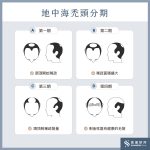 地中海禿頭怎麼辦？搞懂原因、前 …