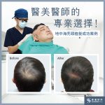 地中海禿頭怎麼辦？搞懂原因、前 …