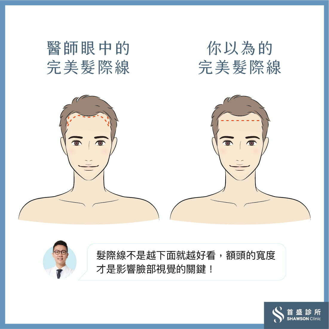 髮際線不是越低越好看，額頭寬度才是影響臉部比例的關鍵！