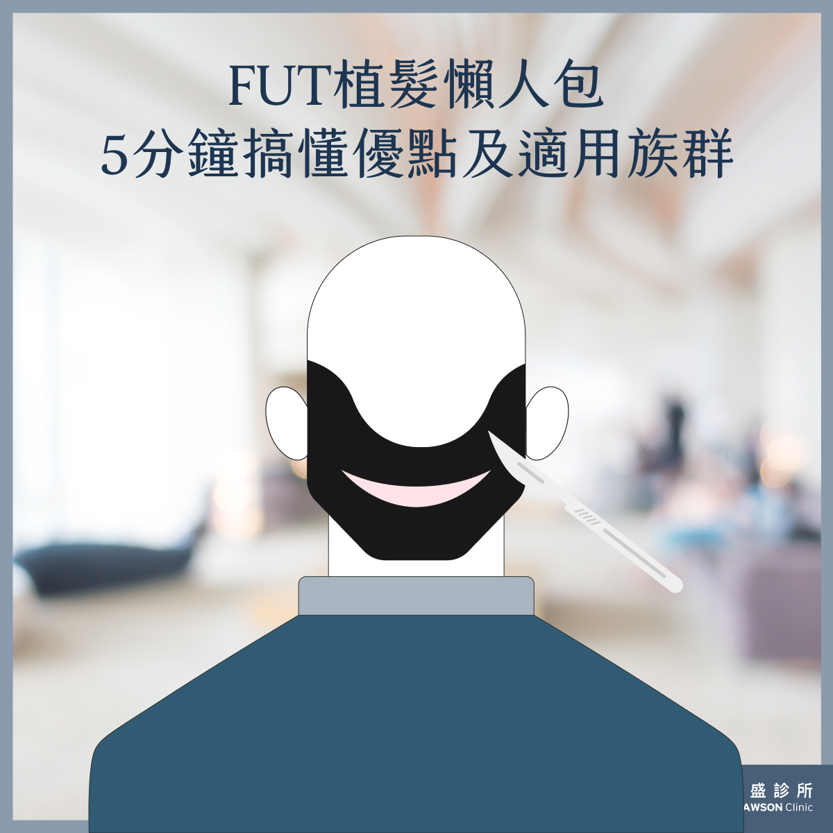 FUT植髮流程、適用族群介紹