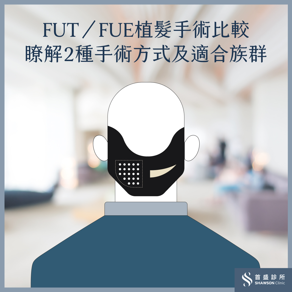 FUT植髮手術是什麼