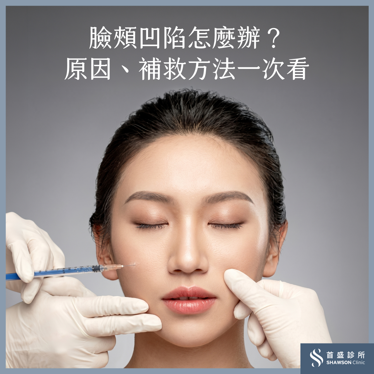 臉頰凹陷醫美