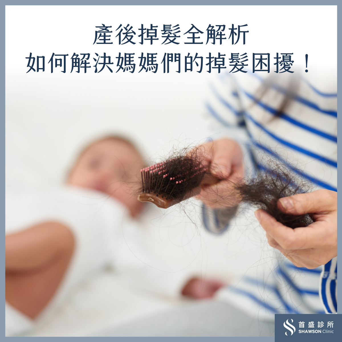 認識媽媽們產後掉髮的原因以及解決方法
