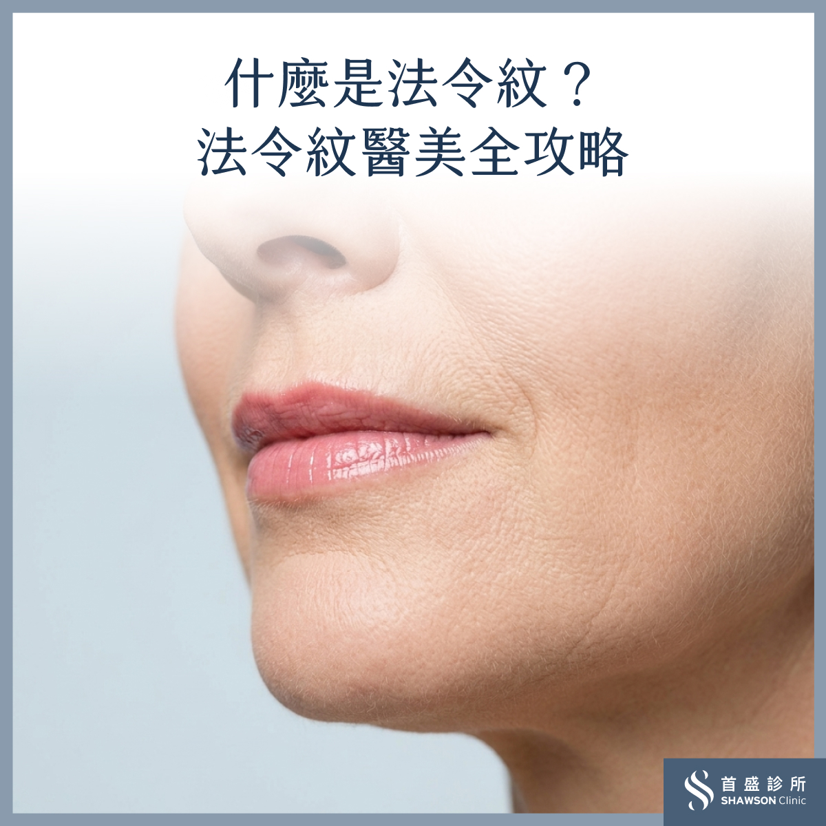 法令紋醫美全攻略