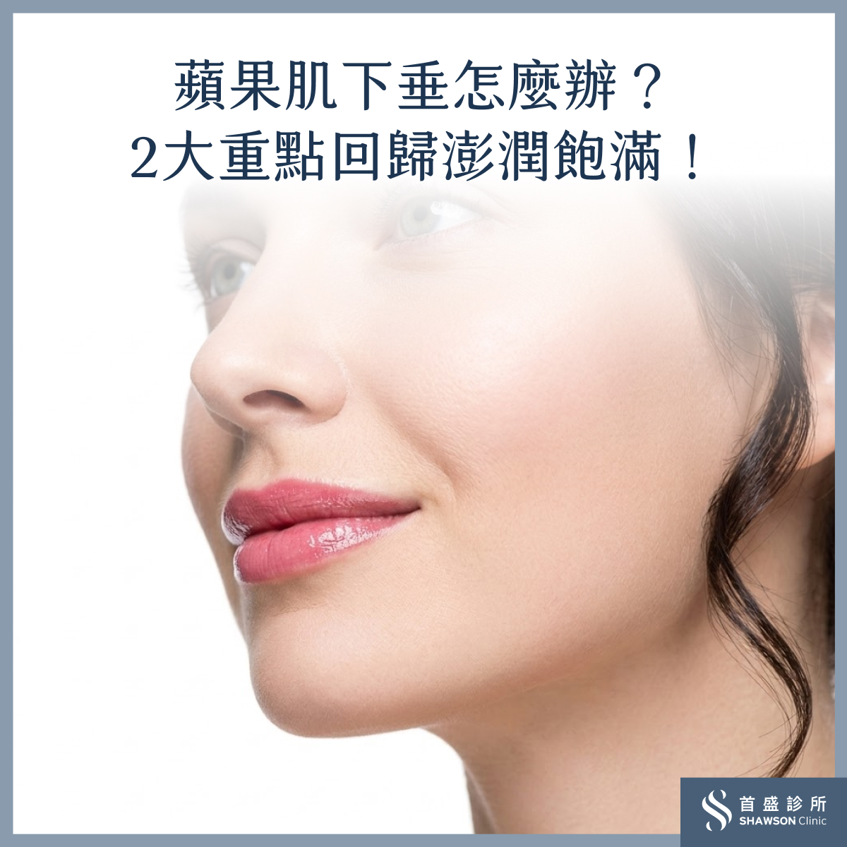 蘋果肌下垂怎麼辦