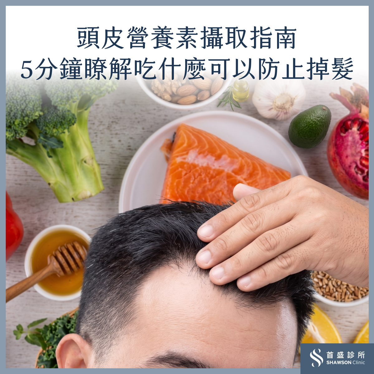 吃什麼可以改善掉髮