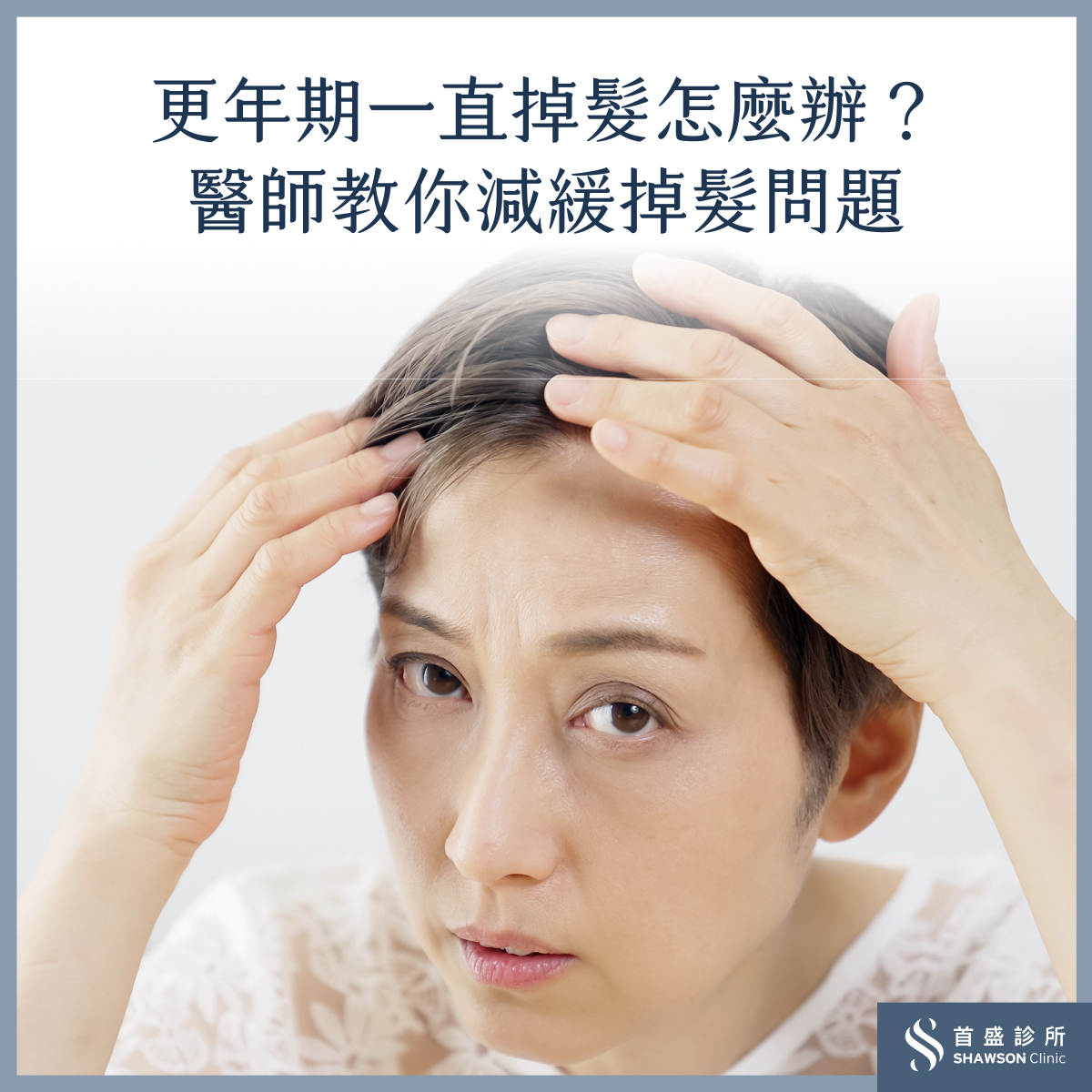 更年期會掉髮嗎?更年期掉髮怎麼辦?