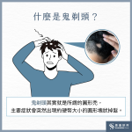鬼剃頭是什麼？鬼剃頭會自己好嗎？鬼剃頭前兆、治療方式 …