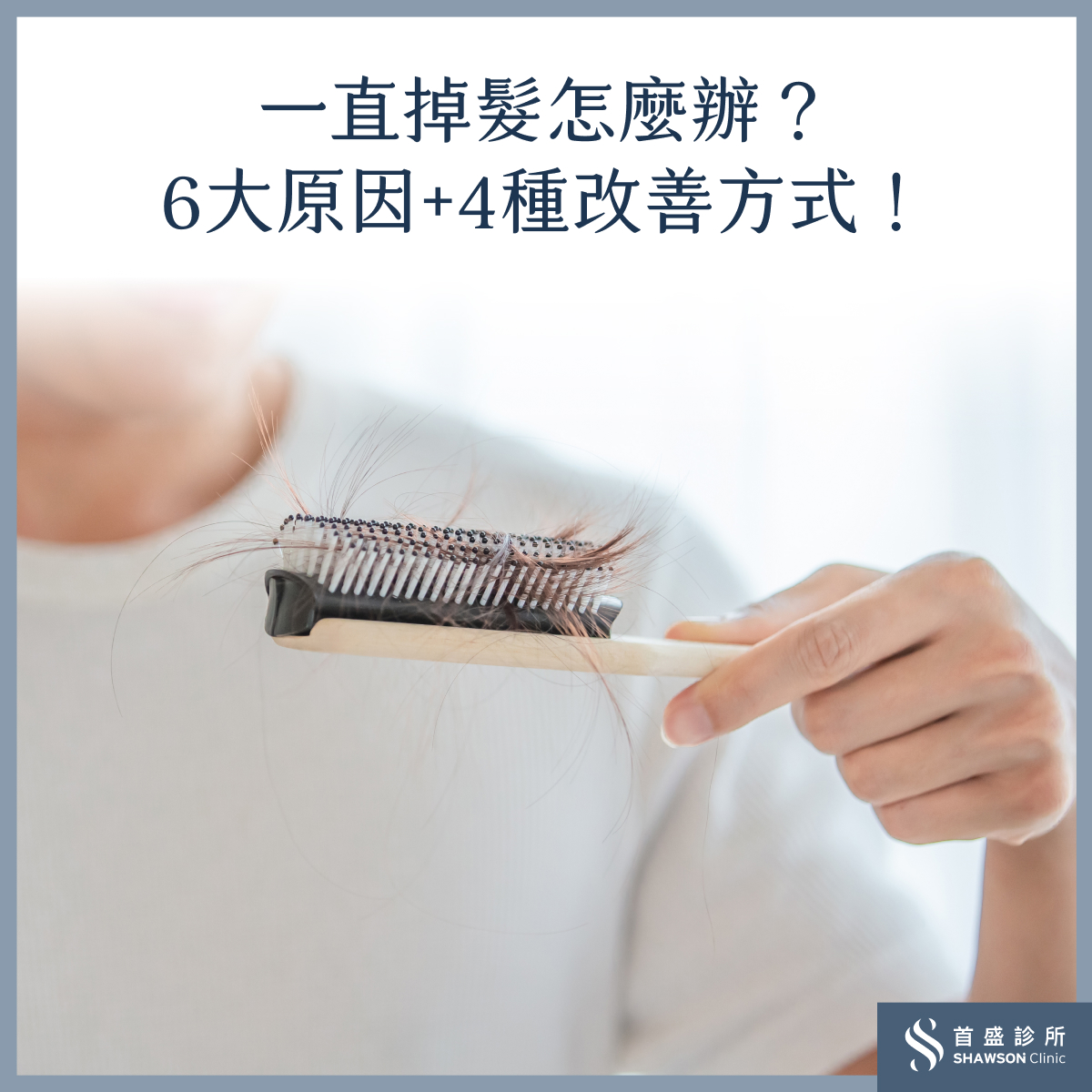 掉髮原因有哪些