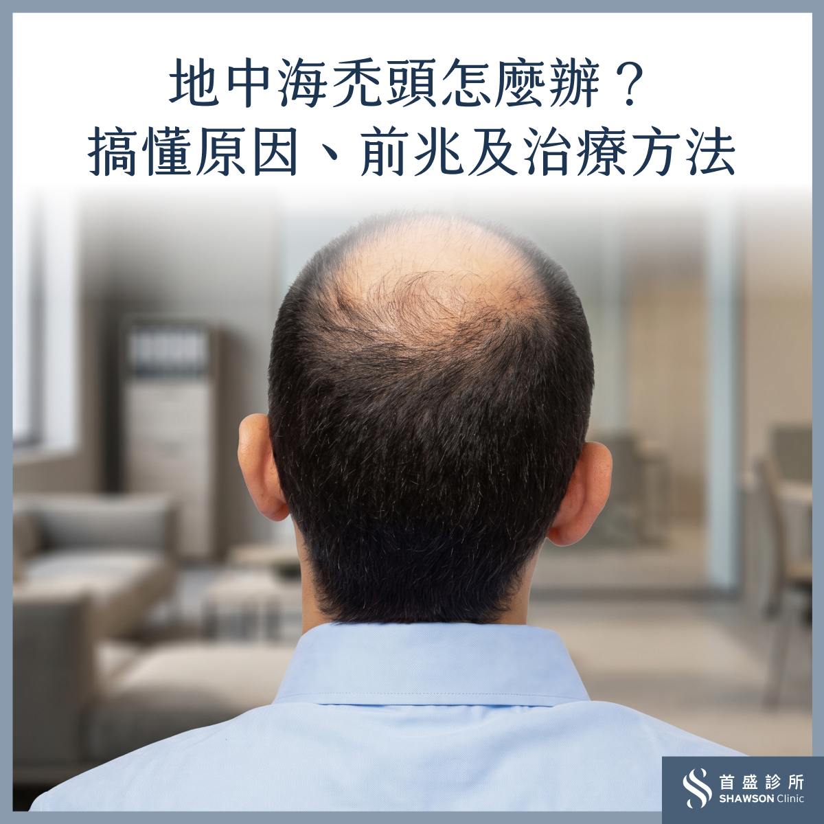 地中海禿頭怎麼辦