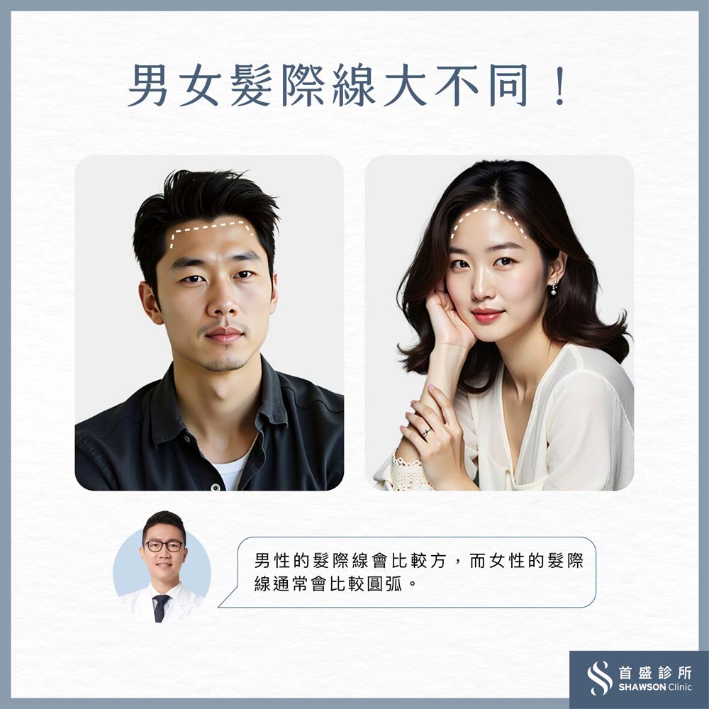 男女髮際線大不同，客製化很重要！