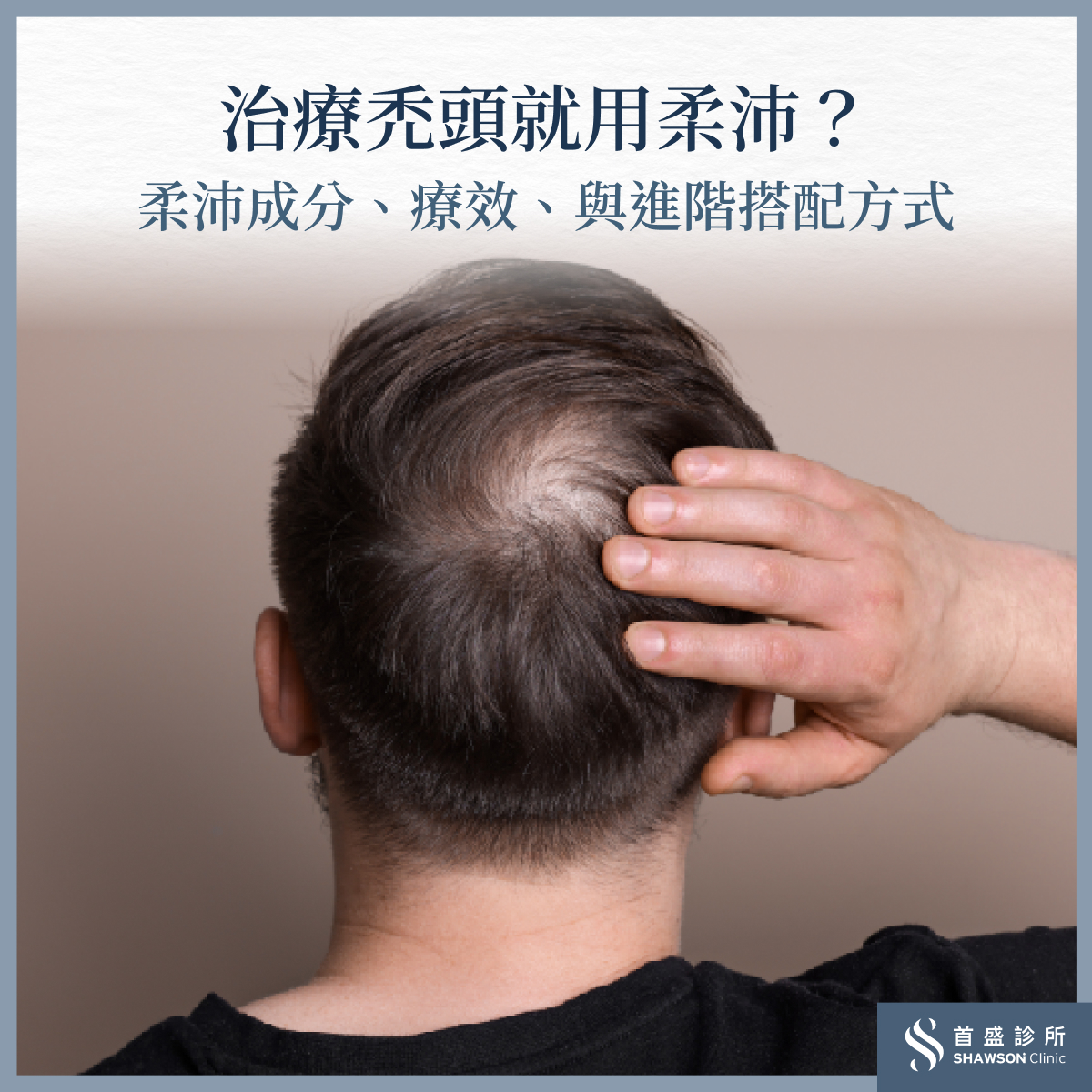 柔沛的治療主要針對男性雄性禿