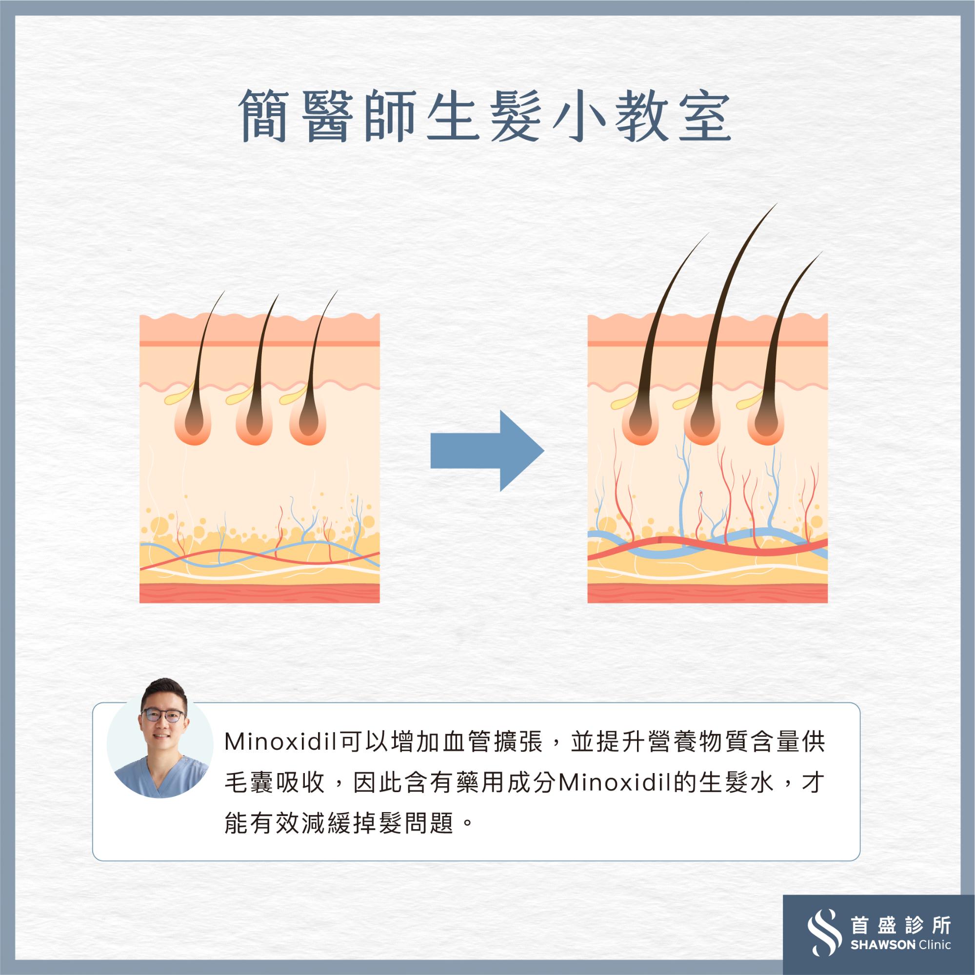 什麼是生髮水