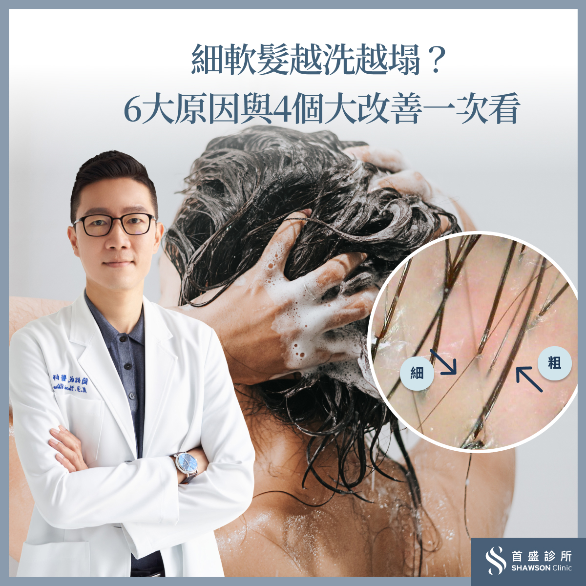 頭髮變細往往不只是單一原因所造成