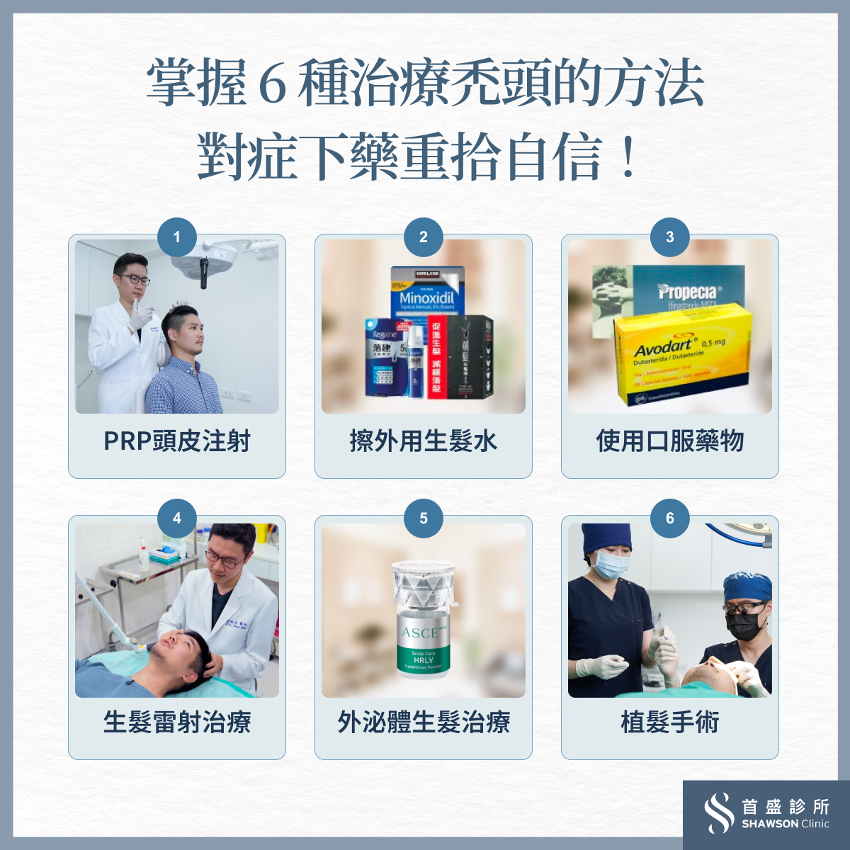 禿頭的6種治療方法