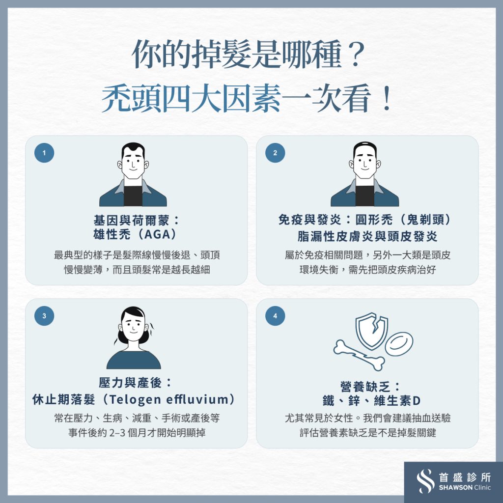 掉髮重點不是馬上選藥,而是先確認你是不是雄性禿,常見禿頭 4 大因素一次看