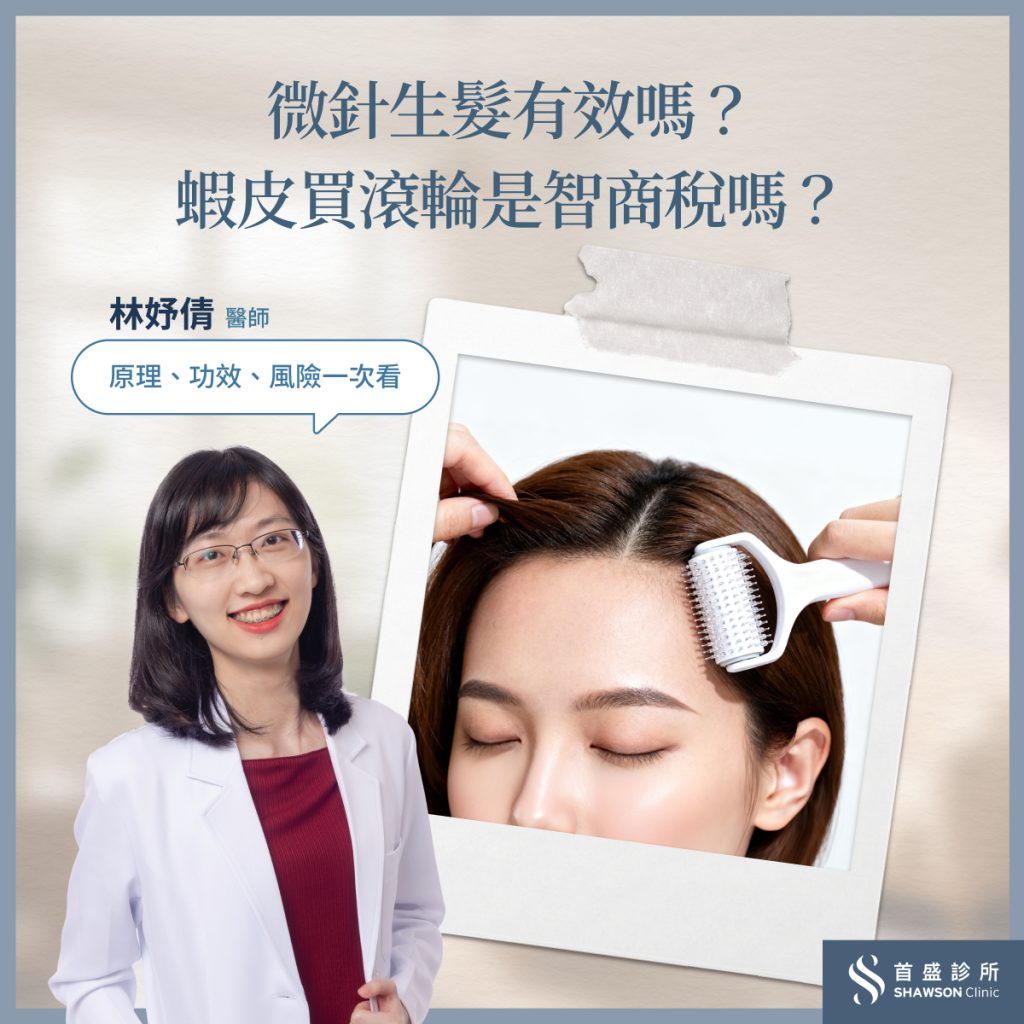 微針生髮原理、功效、風險一次看