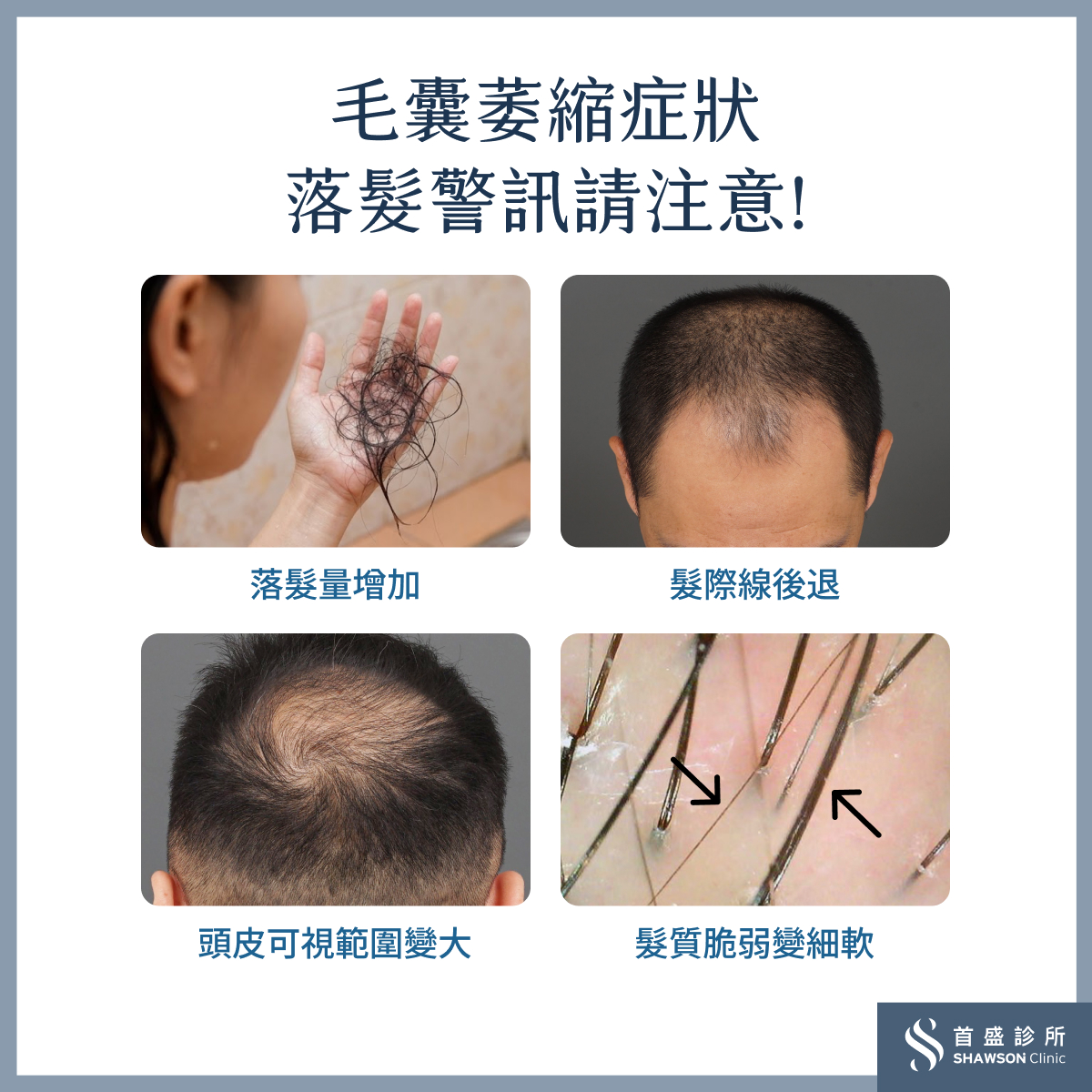 毛囊萎縮症狀