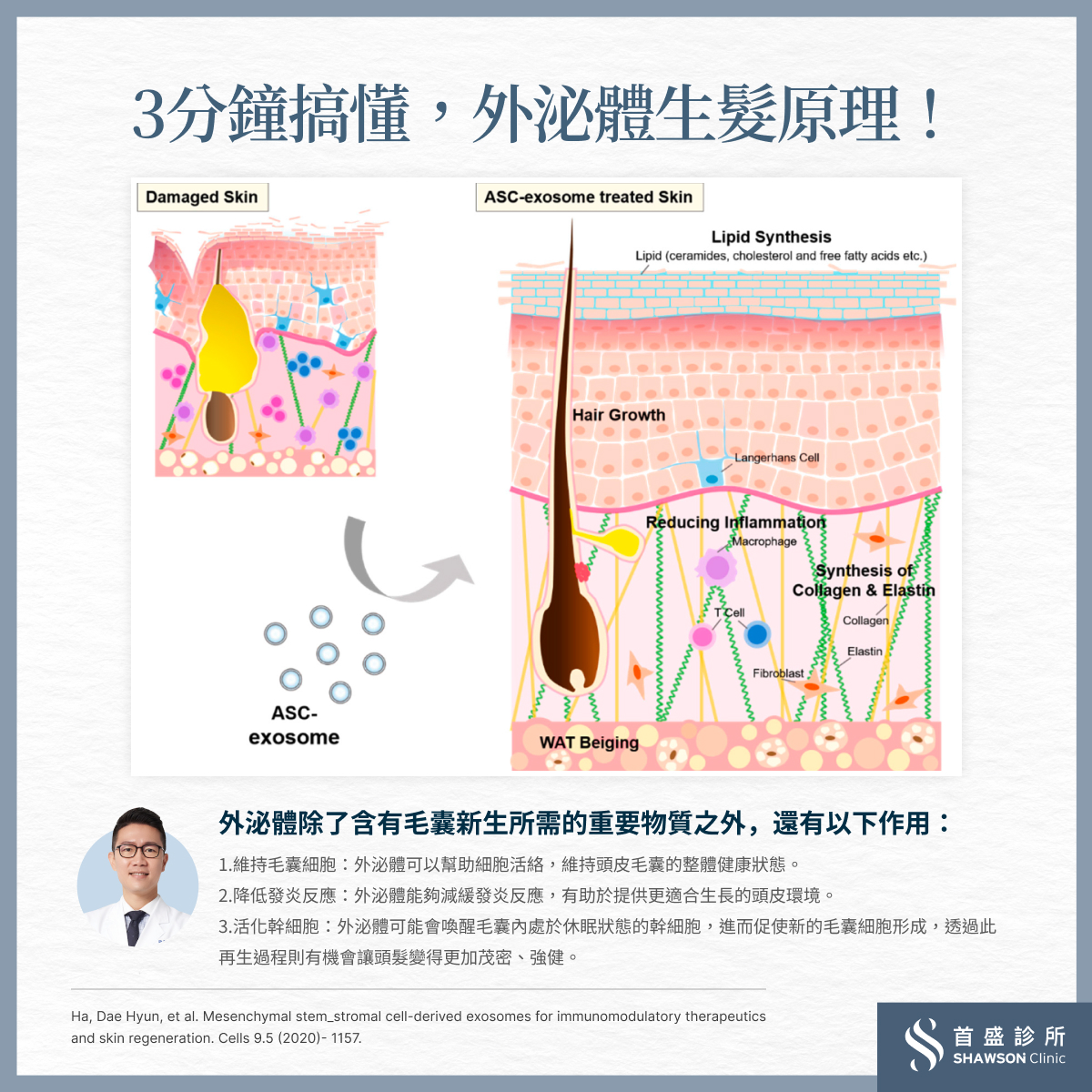 外泌體生髮原理