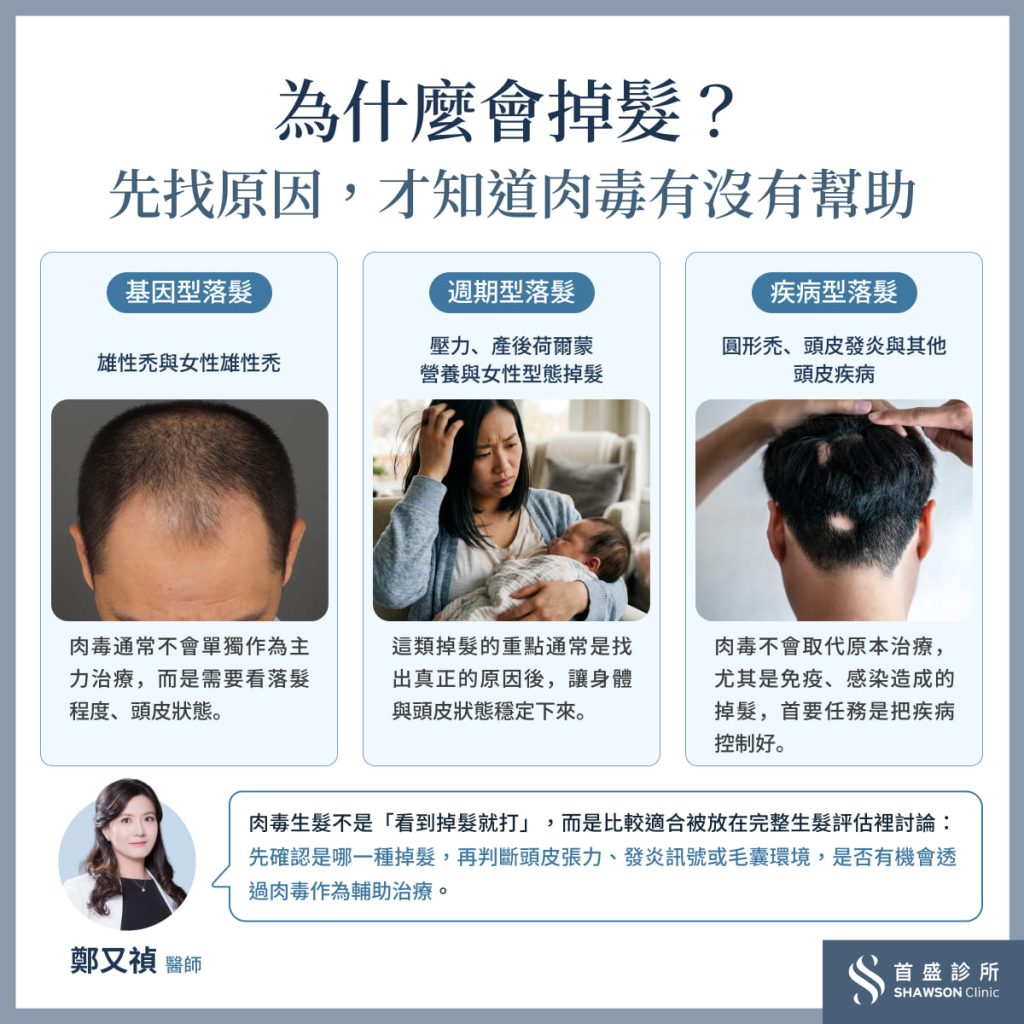 為什麼會掉髮?先找原因,才知到肉毒有沒有幫助