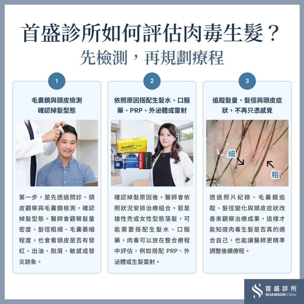 首盛診所如何評估肉毒生髮?先檢測,再規劃療程
